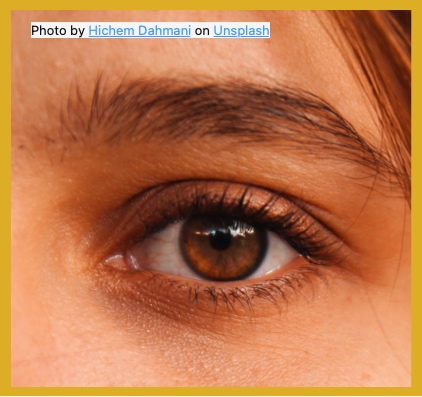 AMD is a common cause of partial and complete vision loss. Here's an image of a healthy eye. 