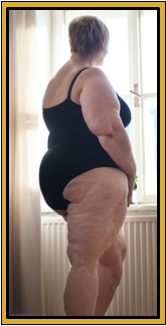 Weight loss isn't easy, but the set-point management plan works to get fat off and keep it off.