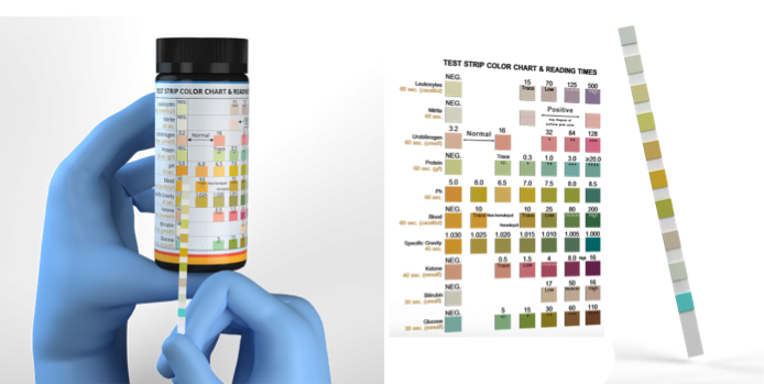 Kidneys produce urine, and it has various qualities. You can measure these with an at home test kit, It's easy.