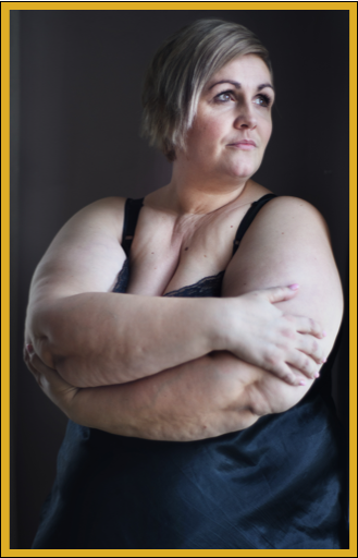 Unique weight loss list of helpers to fight and win the battle of big bellies.